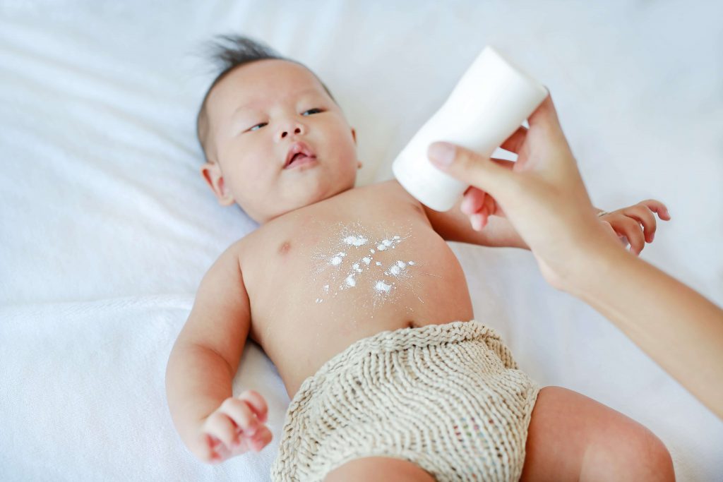 Como prevenir e tratar assaduras em bebês de forma natural?